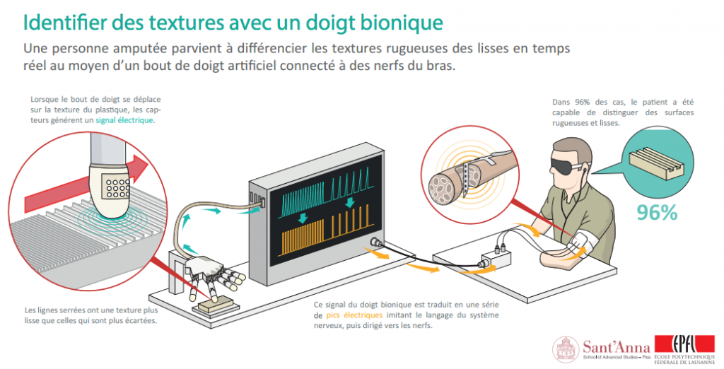 Retrouver le sens du toucher après une amputation